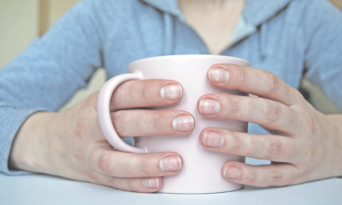 เล็บขาว สาเหตุ และการดูแลสุขภาพเล็บ