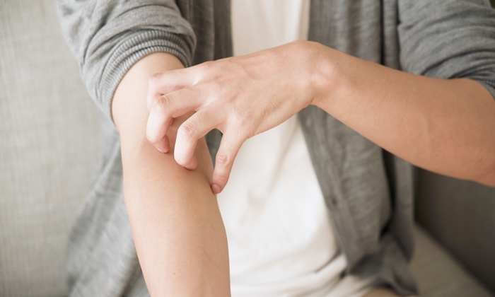 แพ้เหงื่อตัวเอง โรคผิวหนังที่เกิดจากความร้อน