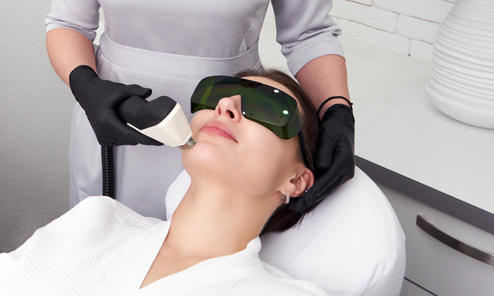 เลเซอร์รอยดำจากสิว ประโยชน์และข้อควรระวัง