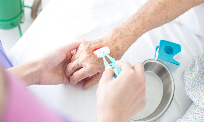 แผลหนอง หรือ แผลเป็นหนอง อาการ สาเหตุ และวิธีรักษา