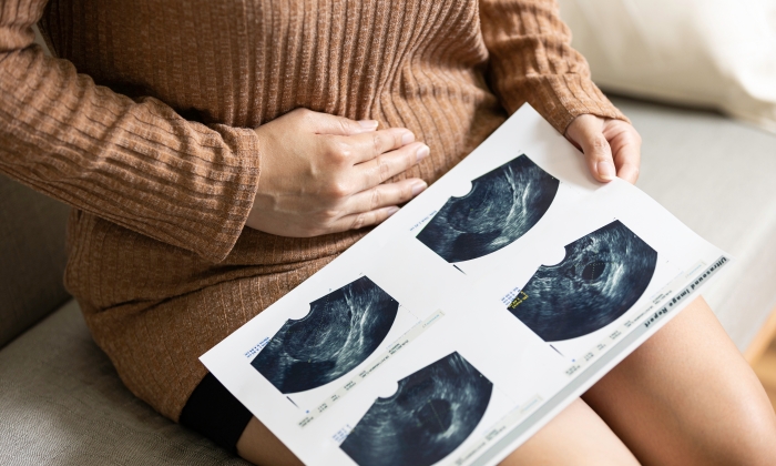 เป็นก้อนแข็งที่อวัยวะเพศหญิง เกิดจากสาเหตุใดได้บ้าง