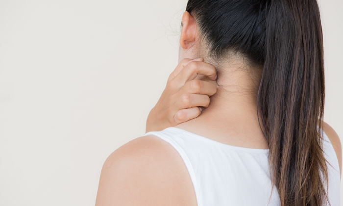 เชื้อราแมว ติดคน อาการ ปัจจัยเสี่ยง และวิธีรักษา