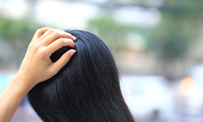 หัวเป็นเชื้อรา เกิดจากอะไร ป้องกันได้อย่างไรบ้าง