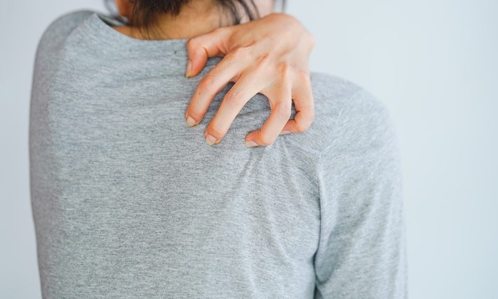 กลากเกลื้อน อาการ สาเหตุ วิธีรักษาและวิธีป้องกัน