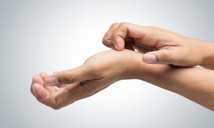 คันฝ่ามือ หรือ คันมือ เกิดจากอะไร และวิธีการรักษา