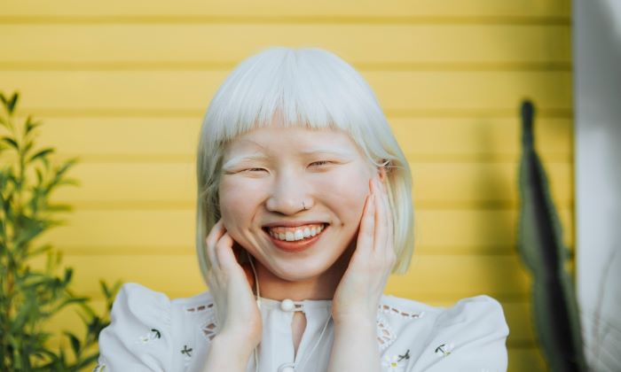 ผิวเผือก เกิดจากอะไร และอันตรายหรือไม่