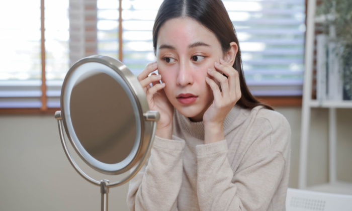 แพ้ครีมทาผิว รักษาอย่างไร ป้องกันได้หรือไม่