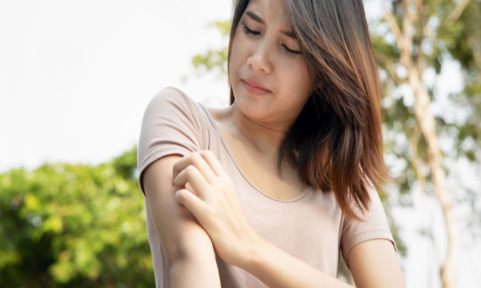 เชื้อราผิวหนัง ป้องกันอย่างไร รักษาให้หายขาดได้หรือไม่