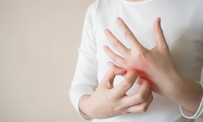 คันมือ สาเหตุและวิธีการดูแลตัวเอง