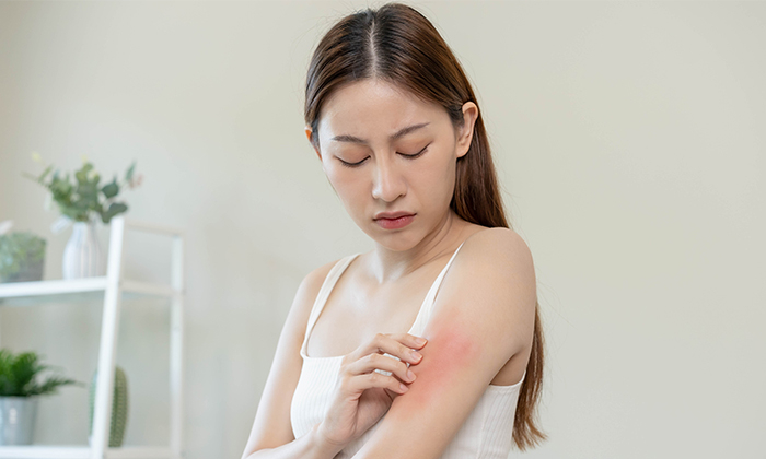 จุดแดงขึ้นตามตัว อาการ สาเหตุและการรักษา