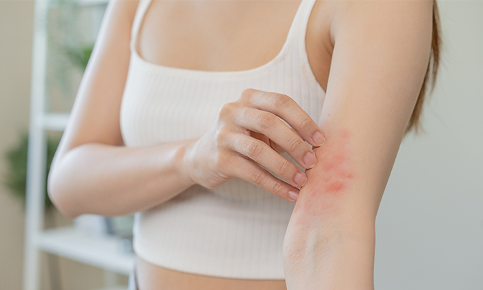 โรคพุ่มพวง อาการ สาเหตุและการรักษา