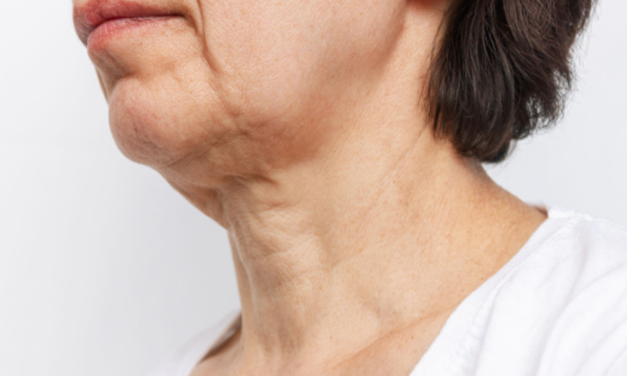 หน้าหย่อนคล้อย เกิดจากอะไร มีวิธีรักษาอย่างไรบ้าง