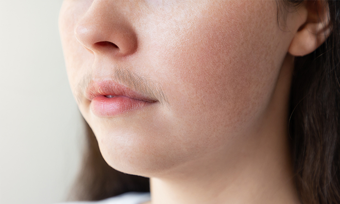 ขนดก สาเหตุ อาการและการรักษา