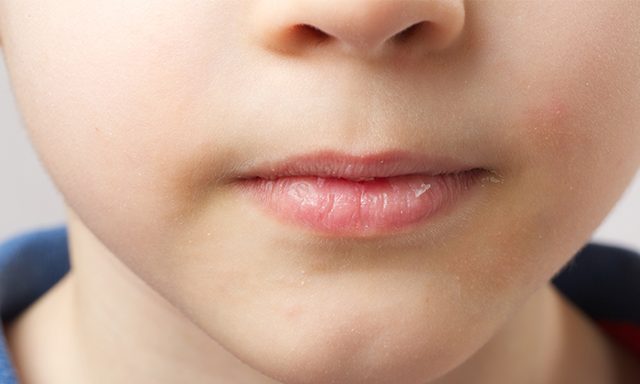 เบาหวาน ปากแห้ง สาเหตุและวิธีบรรเทาอาการ