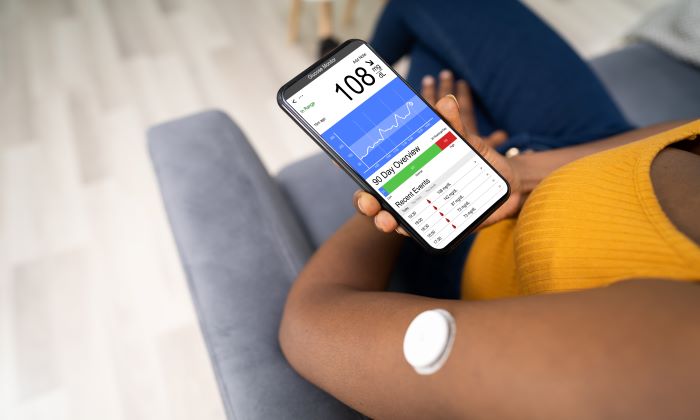 CGM (เครื่องวัดระดับน้ำตาลแบบต่อเนื่อง) คืออะไร ใช้งานอย่างไร
