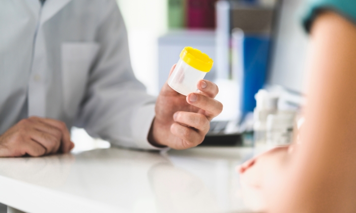 Microalbuminuria คือ อะไร เกี่ยวข้องอย่างไรกับโรคเบาหวาน