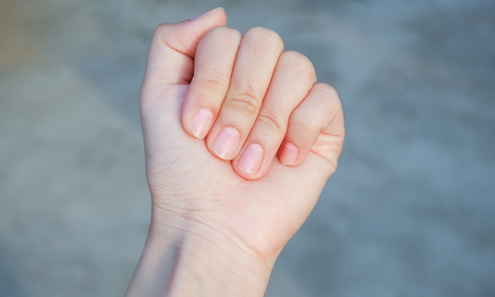 เล็บหลุด เกิดจากสาเหตุใดได้บ้าง และควรดูแลตัวเองอย่างไร