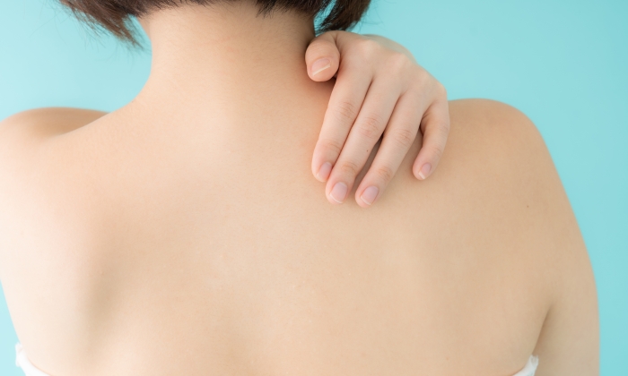 เกลื้อนเกิดจากอะไร รักษาให้หายได้หรือไม่