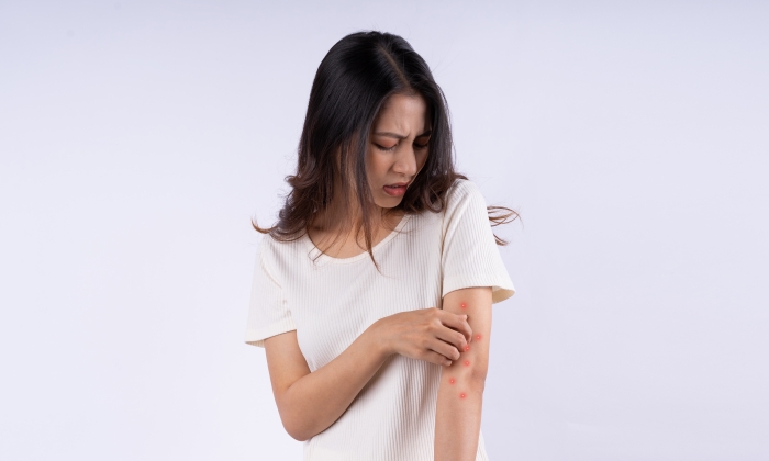 อาการคันตามตัวโดยไม่ทราบสาเหตุ เกิดจากอะไร