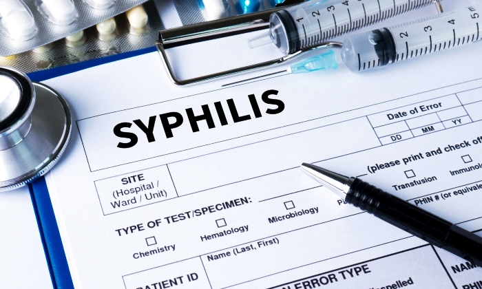 โรคซิฟิลิส คือ อะไร รู้จักและทำความเข้าใจโรคนี้ให้มากขึ้น
