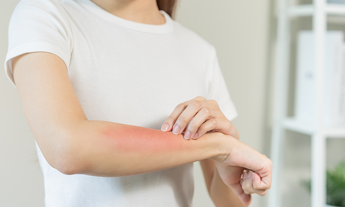 แขน เป็น ตุ่ม เล็ก ๆ เกิดจากสาเหตุอะไรได้บ้าง