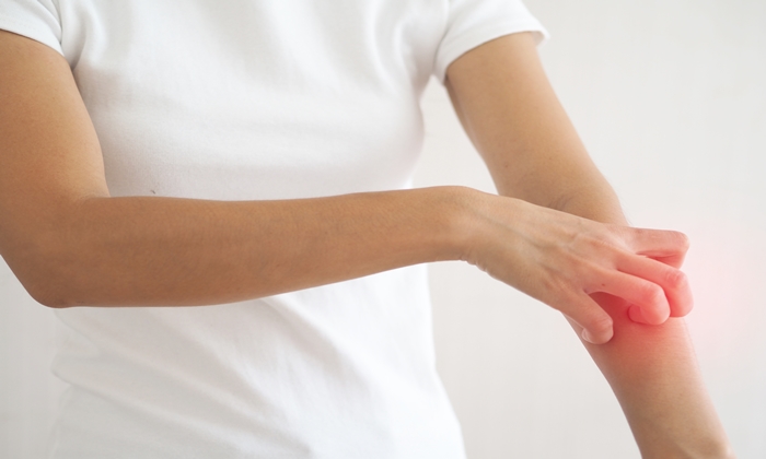 ผื่นแดง เอดส์ เป็นอย่างไร เกิดจากอะไร