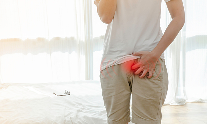 สังคังเป็นยังไง ควรดูแลตัวเอง และรักษาอย่างไร