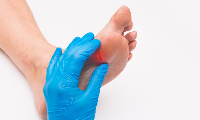 วิธีการ รักษา แผล เบาหวาน มีอะไรบ้าง