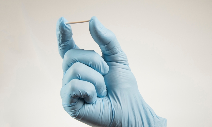 ฝังยาคุม มีประจําเดือนไหม เพราะอะไร