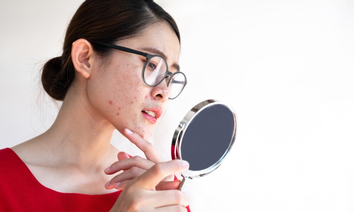 7 วิธีดูแลผิวหน้า แบบธรรมชาติ ทำได้อย่างไรบ้าง