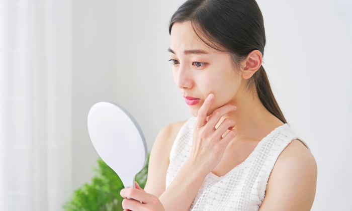 สิวที่แก้ม เกิดจากอะไร และควรดูแลตนเองอย่างไร