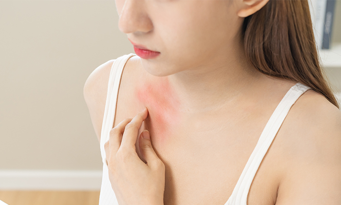 ตุ่มคัน เหมือนยุงกัด เกิดจากอะไรได้บ้าง