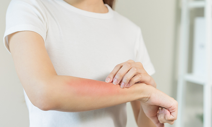 มีตุ่มขึ้นเหมือนสิว เม็ดสีขาวขุ่นเล็กๆ เกิดจากอะไร และควรป้องกันอย่างไร