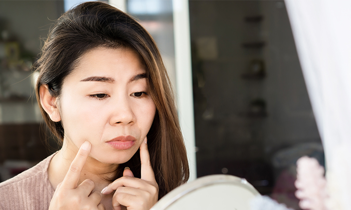 ร่องแก้มลึก เกิดจากอะไร ควรรักษา และดูแลตัวเองอย่างไร