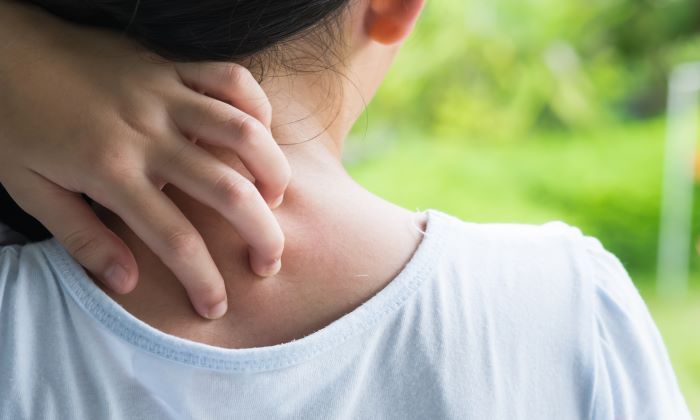 Folliculitis คือ อะไร มีอาการ และการรักษาอย่างไร