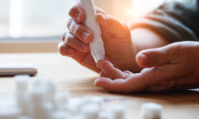 Blood Sugar คือ อะไร เกี่ยวข้องอย่างไรกับโรคเบาหวาน