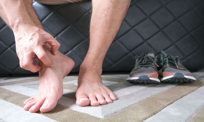 น้ำกัดเท้า โรคผิวหนังที่พบบ่อยในหน้าฝน มีวิธีการรักษาอย่างไร