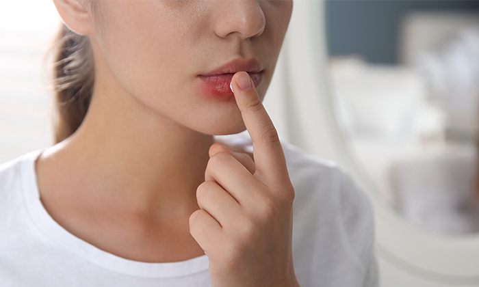 ปากเป็นแผล สาเหตุและการดูแลรักษา  