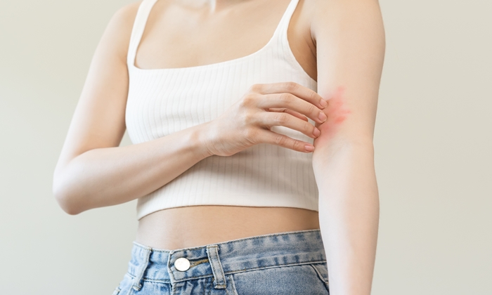 ผิวแห้งคัน สาเหตุ อาการ วิธีรักษาและการดูแลตัวเอง