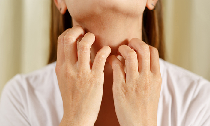 ผื่นโควิดคันไหม อาการทางผิวหนังของโรคโควิด 19