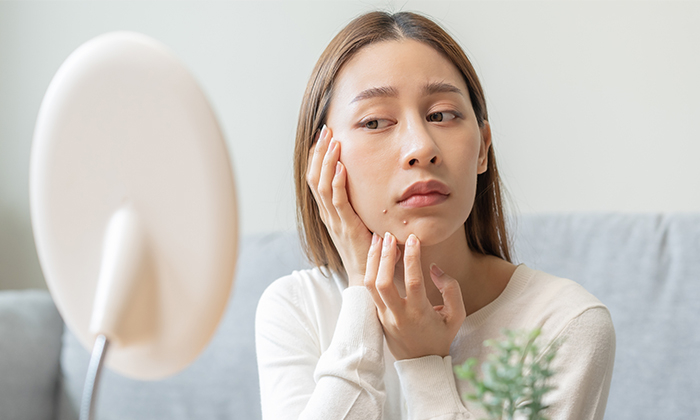 สิวอักเสบไม่มีหัว เกิดจาก อะไร การรักษา และการป้องกัน