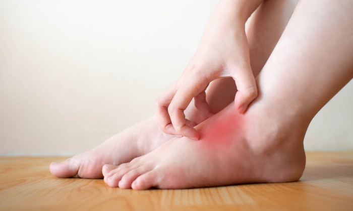 ตุ่ม เบาหวาน มีลักษณะอาการอย่างไร รักษาได้อย่างไร