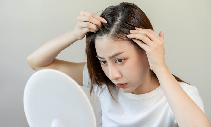 สิวขึ้นหัว เกิดจากอะไร รักษาหรือป้องกันได้อย่างไร