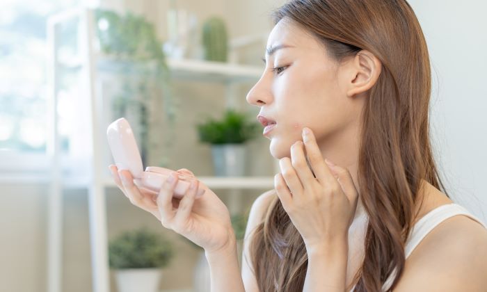 สิวไม่มีหัว นูนๆ หรือสิวตุ่มนูน สาเหตุ และการรักษา