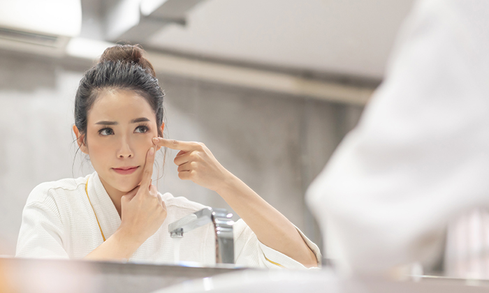 สิวไม่มีหัว เป็นไต เกิดจากอะไร ควรรักษาอย่างไร