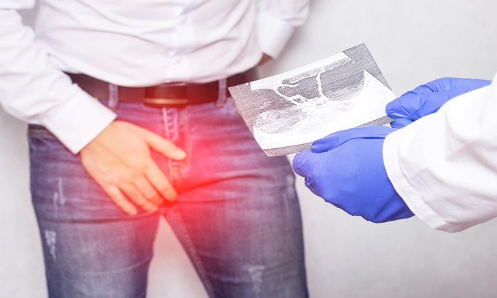 Hydrocele คืออะไร มีสาเหตุ อาการ และการรักษาอย่างไร