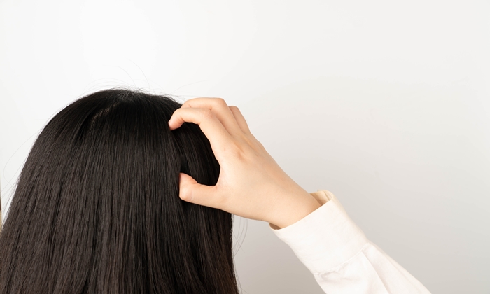 เชื้อราบนหนังศีรษะ อาการ เป็นอย่างไร เกิดจากสาเหตุอะไรบ้าง