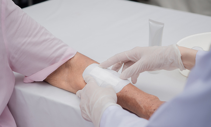 แผลอักเสบ เป็นอย่างไร และส่งผลต่อสภาพผิวหนังอย่างไร