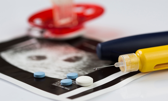 การรักษาภาวะมีบุตรยากด้วย IUI คือ อะไร