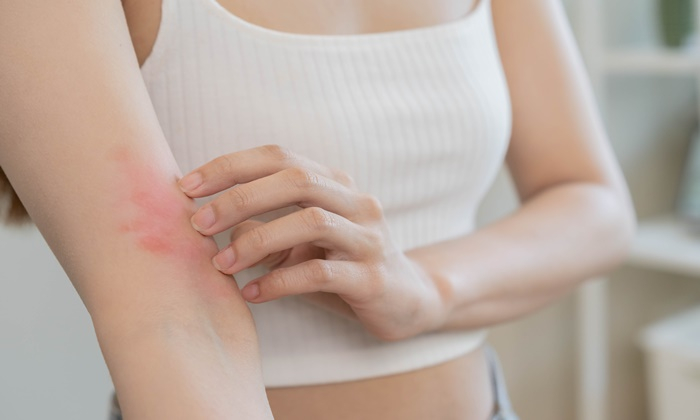 อาการโรคเอดส์ สาเหตุ การรักษาและวิธีป้องกัน